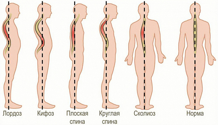 Спина фото женская с описанием позвонков